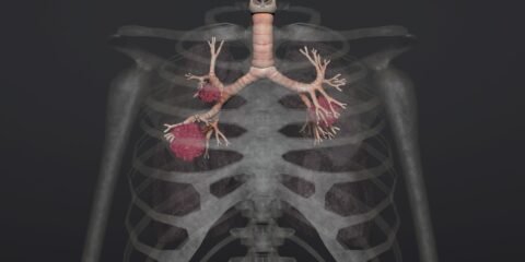 Asbestos Awareness Training